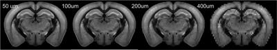 Mouse brain MR super-resolution using a deep learning network trained with optical imaging data